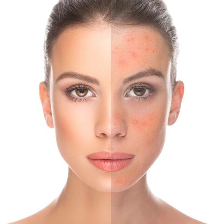 درمان پوست برای درخشش و سلامتی 3